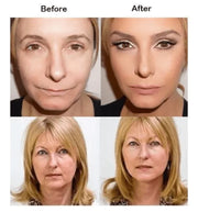 Ultra Secret Lift Pro - Instant Neck Lift