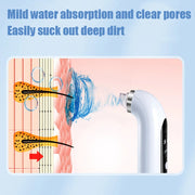 Hydrodermabrasion Machine