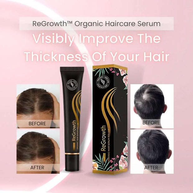 Regrowth Organic Hair Serum Roller