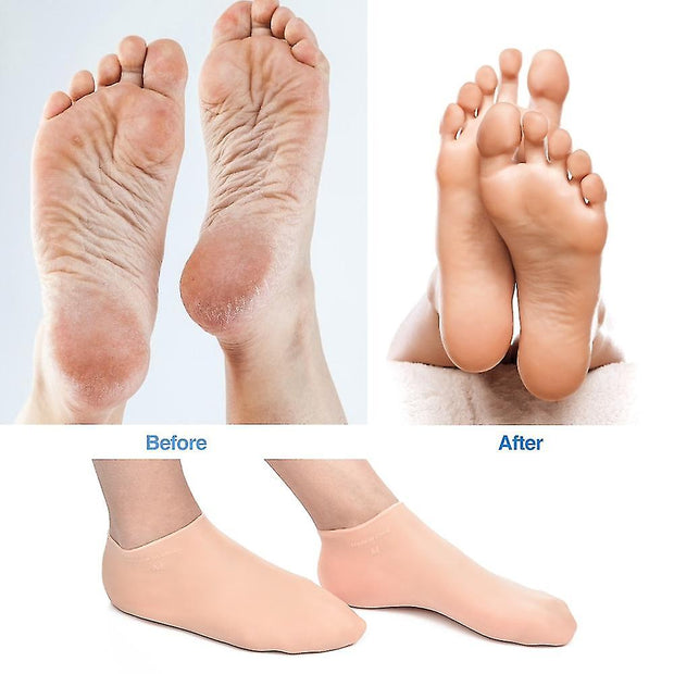 Feet & Hand Care Socks Gloves Moisturizing Silicone Gel