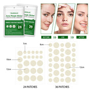 Natural ingredients -Acne Pimple Sticker Treatment