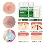 Natural ingredients -Acne Pimple Sticker Treatment